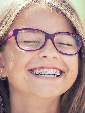 braces